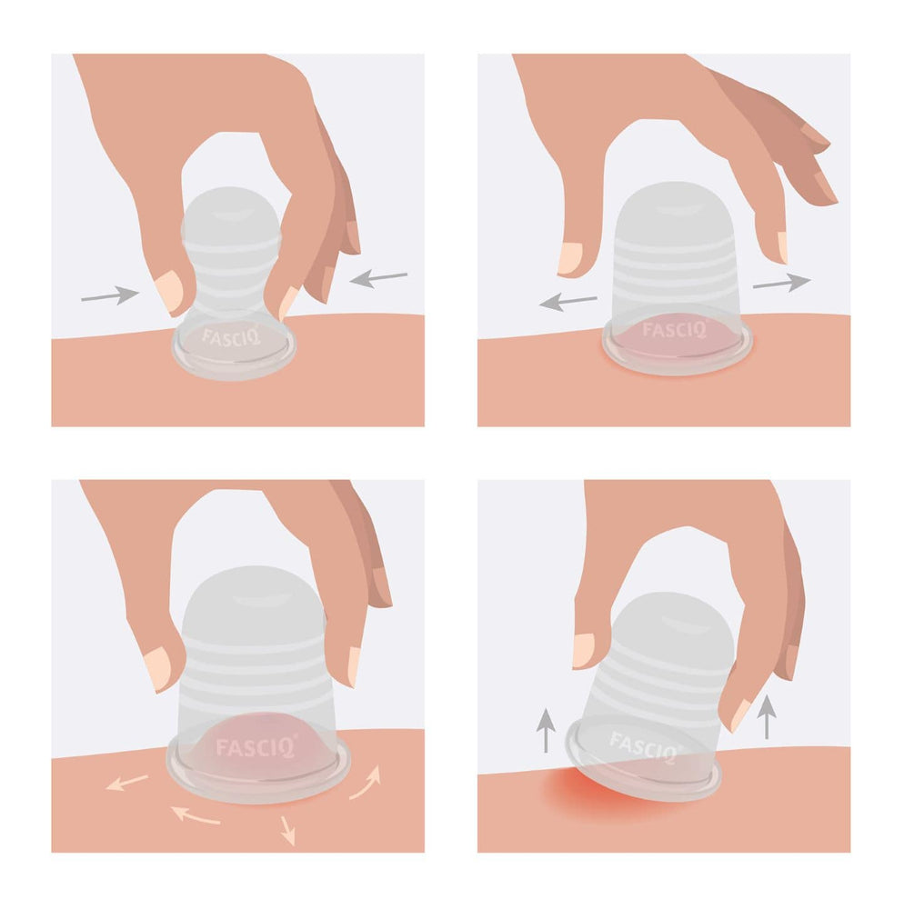 FASCIQ® Ultimate Cupping Collection