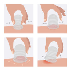 FASCIQ® Ultimate Cupping Collection