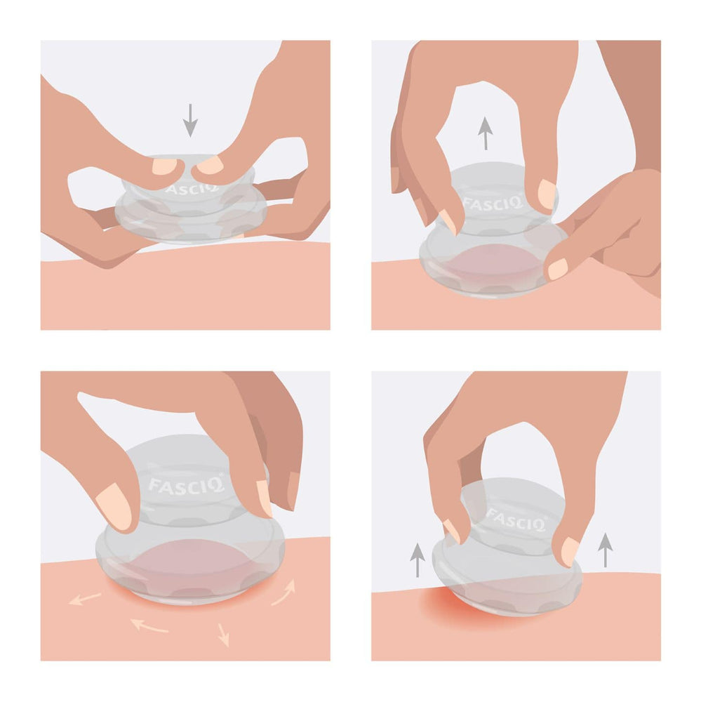 FASCIQ® Ultimate Cupping Collection