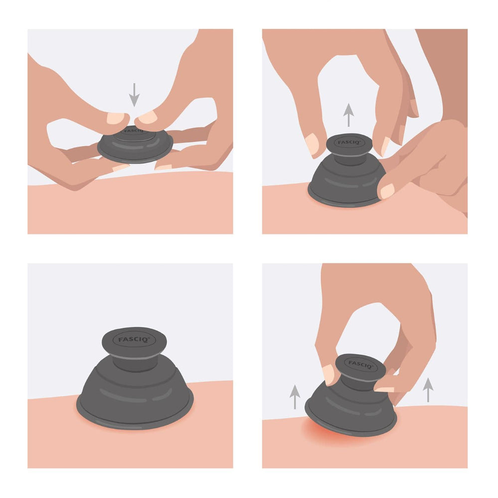 FASCIQ® Ultimate Cupping Collection