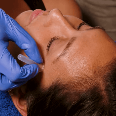 Silicone Facial Cupping Set