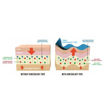 2.5cm Kinesiology Tape