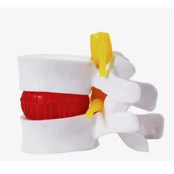 Herniated Disc